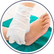Foot Surgery