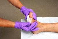 Debridement of Foot Wounds and Ulcers